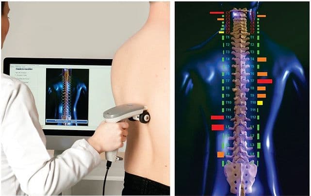 Avaliação com Termoscanner